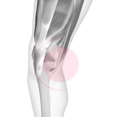 Боли в коленях: причины, диагностика и лечение