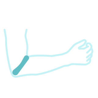 Артроз локтевого сустава