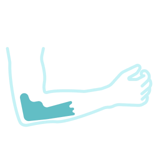 Медиальный и латеральный эпикондилиты